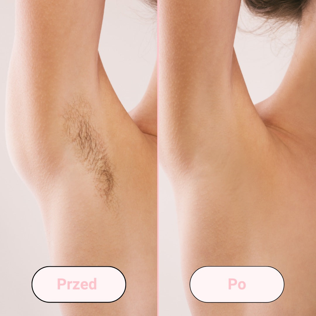 Removely IPL 3+ (Try & Buy - Poland)