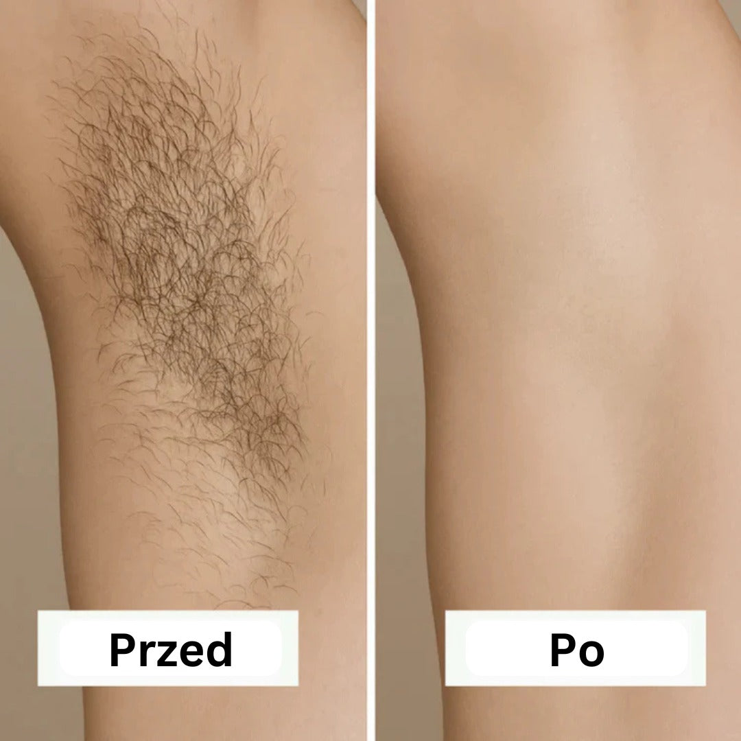 Removely IPL 3+ (Try & Buy - Poland)